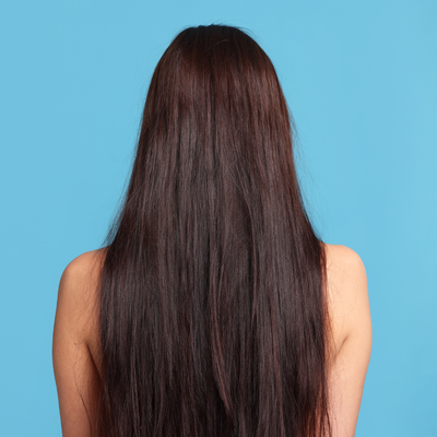 Before - Rachel P, 31 Years Old