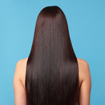 After - Rachel P, 31 Years Old