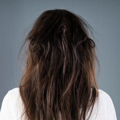 Before - Nicole B, 26 Years Old