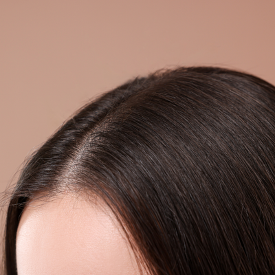 After - Lauren G, 28 Years Old