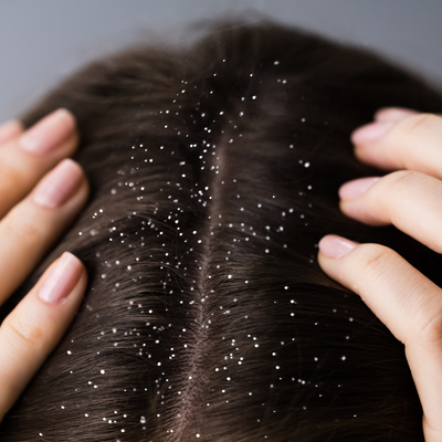 Before - Stephanie C, 30 Years Old