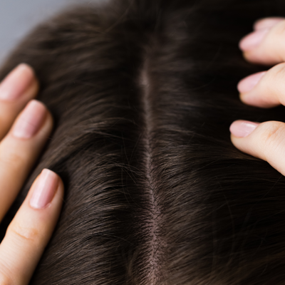 After - Stephanie C, 30 Years Old