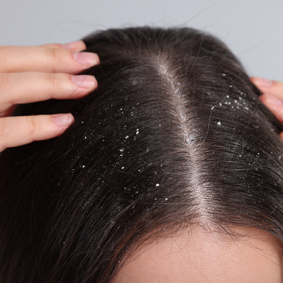 Before - Danielle F, 31 Years Old