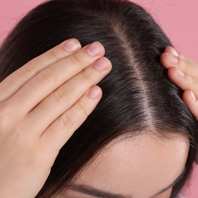 After - Danielle F, 31 Years Old