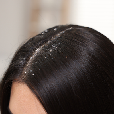 Before - Lauren G, 28 Years Old