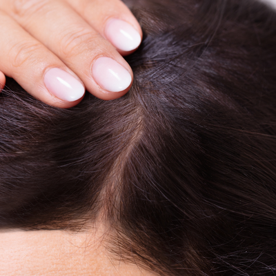 After - Jennifer W, 34 Years Old