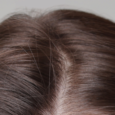 Before - Christina H, 36 Years Old