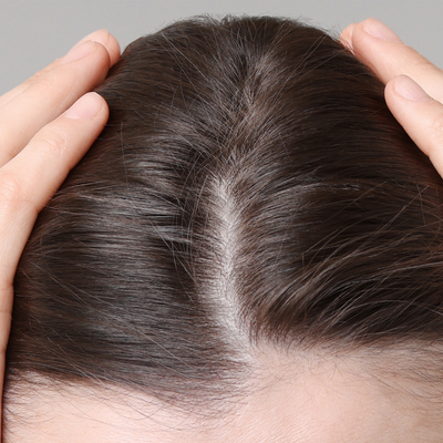 Before - Kelly D, 29 Years Old