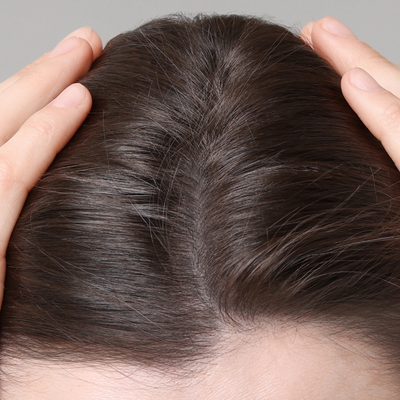 After - Kelly D, 29 Years Old