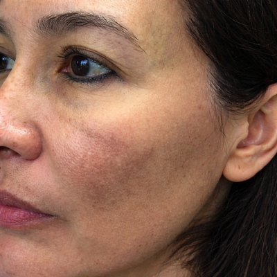 Before - Mariah Z, 30 Years Old