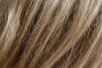 Before - Lisa T, 27 Years Old